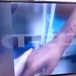 Ανατριχίλα προκαλούν οι εικόνες με τις πληγές στα δύο αδελφάκια στη Λάρισα