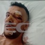 Σοκάρει η επίθεση με μαχαίρι σε 35χρονο στην Μυτιλήνη: «Έχει τρύπες σε πνεύμονα, διάφραγμα και του κόπηκαν οι μύες»