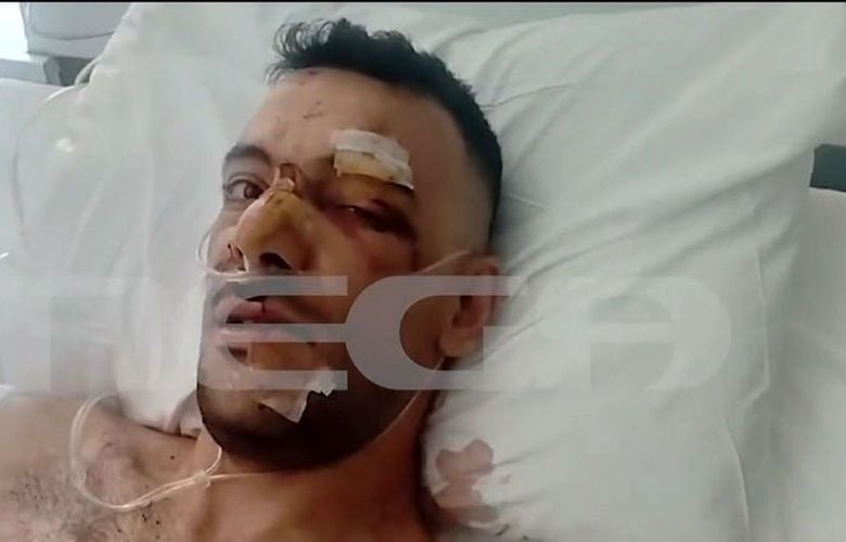 Σοκάρει η επίθεση με μαχαίρι σε 35χρονο στην Μυτιλήνη: «Έχει τρύπες σε πνεύμονα, διάφραγμα και του κόπηκαν οι μύες»