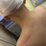 Ξυλοδαρμός 13χρονου: Δίωξη για απόπειρα ανθρωποκτονίας στον 18χρονο που συνελήφθη
