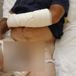 Βελεστίνο - σκύλοι - επίθεση