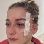 Άγριο ξύλο σε αγώνα του γυναικείου πρωταθλήματος μπάσκετ γυναικών