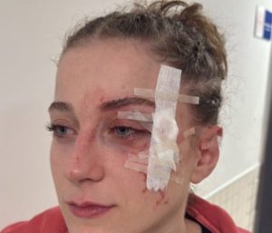 Άγριο ξύλο σε αγώνα του γυναικείου πρωταθλήματος μπάσκετ γυναικών