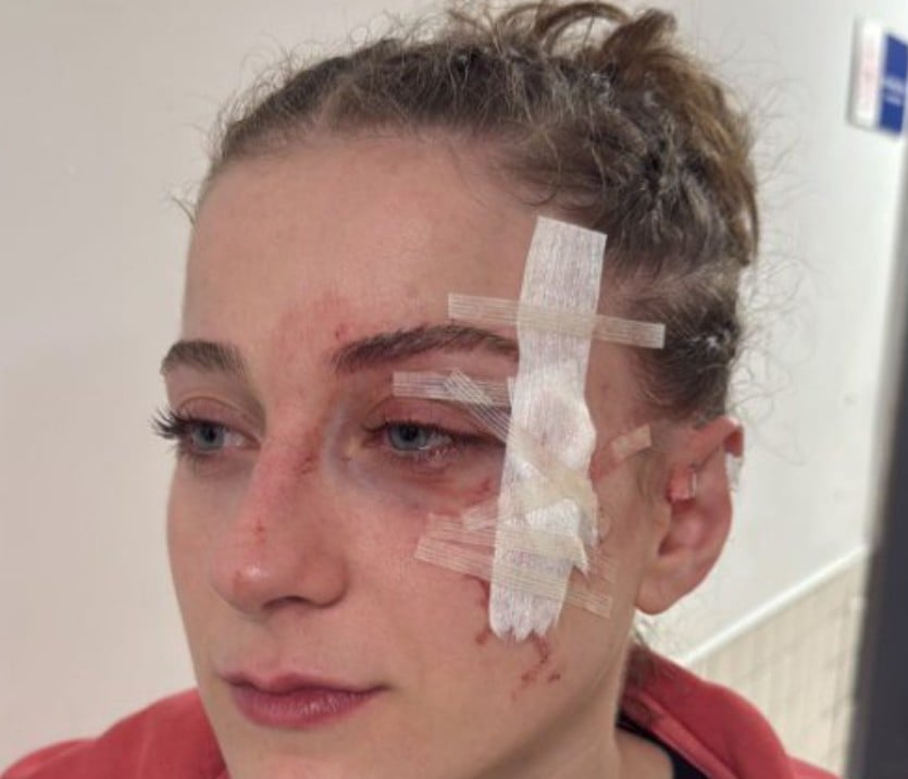 Άγριο ξύλο σε αγώνα του γυναικείου πρωταθλήματος μπάσκετ γυναικών