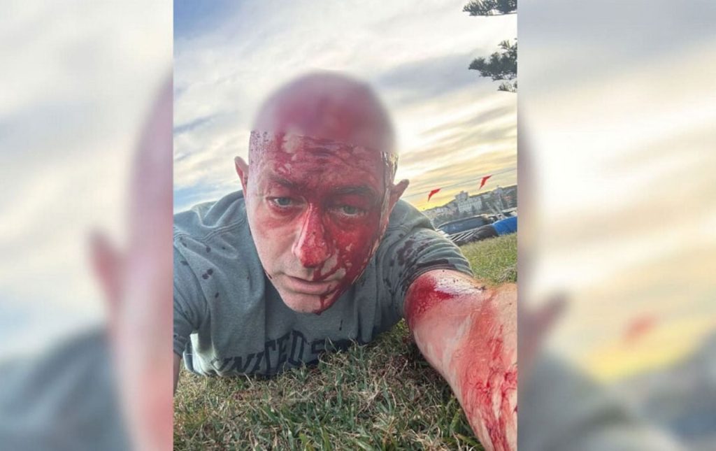 Επιζών της 7ης Οκτωβρίου έζησε και το μακελειό του Σίδνεϊ