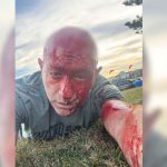 Επιζών της 7ης Οκτωβρίου έζησε και το μακελειό του Σίδνεϊ