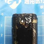 Κίνα: Κατάπιε αναπτήρα πριν 30 χρόνια – Ακόμα λειτουργούσε στο στομάχι του