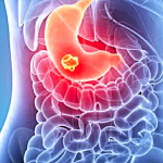 Με πεπτικά προβλήματα συνδέεται το άγχος κατά την πρώιμη παιδική ηλικία